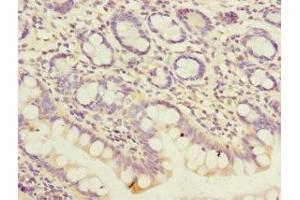 Immunohistochemistry of paraffin-embedded human small intestine tissue using ABIN7162961 at dilution of 1:100