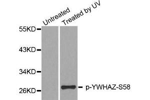 Western blot analysis of extracts from Hela cells, using Phospho-YWHAZ-S58 antibody.
