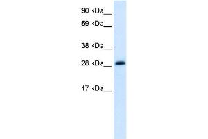 WB Suggested Anti-ABT1 Antibody Titration:  1. (Activator of Basal Transcription 1 anticorps  (Middle Region))