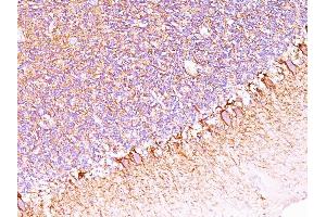 Formalin-fixed, paraffin-embedded human Cerebellum stained with Neurofilament Monoclonal Antibody (SPM563). (NEFH anticorps)