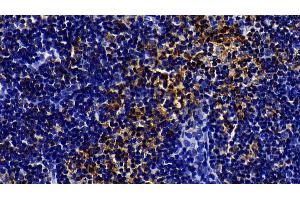 Detection of TLR5 in Rat Lymph node Tissue using Polyclonal Antibody to Toll Like Receptor 5 (TLR5)