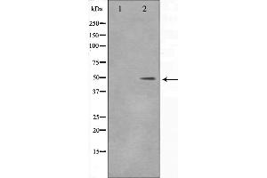 Western blot analysis on 293 cell lysate using DLX3 Antibody,The lane on the left is treated with the antigen-specific peptide. (DLX3 anticorps  (Internal Region))