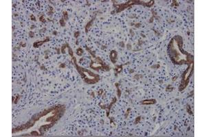 Immunohistochemistry on paraffin sections of human pancreas epithelia strongly positive (Cytokeratin 7 anticorps)