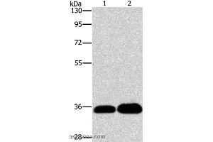 Western blot analysis of K562 and 293T cell, using LIN28B  Polyclonal Antibody at dilution of 1:550 (LIN28B anticorps)