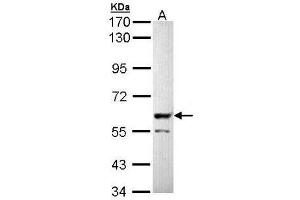 Western Blot analysis: PPP3CB antibody staining of Molt-4 whole cell lysate (Lane A, 30 µg) at 1/5000 dilution. (PPP3CB anticorps)