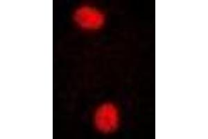 Immunofluorescent analysis of PRPF3 staining in U2OS cells. (PRPF3 anticorps)