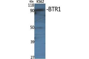 Western Blot (WB) analysis of specific cells using BTR1 Polyclonal Antibody. (SLC4A11 anticorps  (Internal Region))