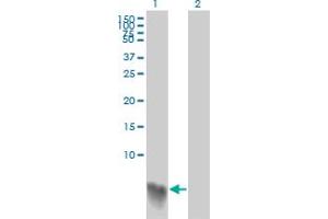 Western Blot analysis of S100A2 expression in transfected 293T cell line by S100A2 monoclonal antibody (M03), clone 3H8.