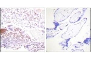 Immunohistochemistry analysis of paraffin-embedded human placenta, using p57 Kip2 (Phospho-Thr310) Antibody. (CDKN1C anticorps  (pThr310))