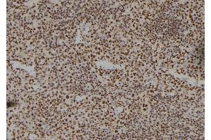 ABIN6262339 and ABIN6279487 at 1/100 staining Mouse spleen tissue by IHC-P. (Homeobox A11 anticorps)