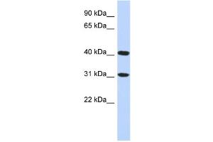 WB Suggested Anti-FAM46D Antibody Titration: 0.