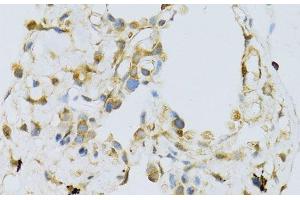Immunohistochemistry of paraffin-embedded Human lung using RPL13 Polyclonal Antibody at dilution of 1:100 (40x lens).