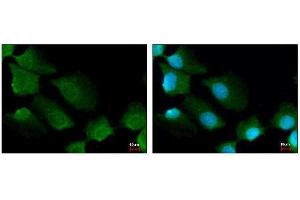 ICC/IF Image 14-3-3 sigma antibody [C1C3] detects 14-3-3 sigma protein at cytoplasm by immunofluorescent analysis.