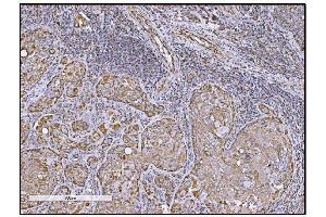 IHC analysis of FABP-1/GOT2 using anti-FABP-1/GOT2 antibody (ABIN7601426). (GOT2 anticorps  (AA 35-430))