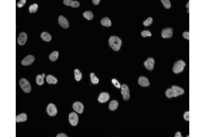 Immunofluorescent staining of A549 (ATCC CCL-185) cells. (NONO anticorps  (AA 368-471))