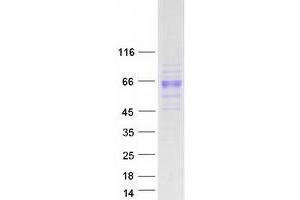 Validation with Western Blot