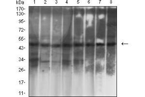 Western blot analysis using KRT19 mouse mAb against T47D (1), MCF-7 (2), HepG2 (3), SW620 (4), HT-29 (5), HCT116 (6), PC-12 (7), and C6 (8) cell lysate.