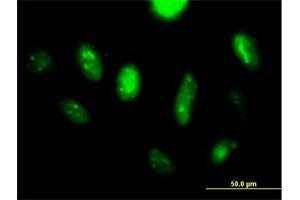Immunofluorescence of purified MaxPab antibody to LANCL2 on HeLa cell.