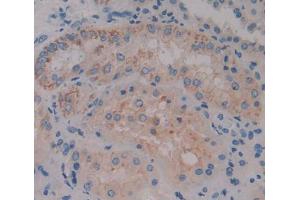 Used in DAB staining on fromalin fixed paraffin- embedded kidney tissue (ACOX1 anticorps  (AA 210-409))