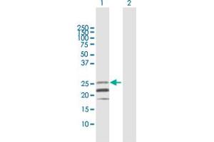 Western Blot analysis of CD70 expression in transfected 293T cell line by CD70 MaxPab polyclonal antibody. (CD70 anticorps  (AA 1-193))