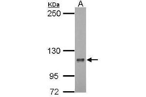 WB Image Sample (30 ug of whole cell lysate) A: 293T 5% SDS PAGE antibody diluted at 1:1000 (DLGAP5 anticorps  (Internal Region))