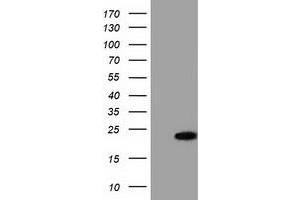Western Blotting (WB) image for anti-Acireductone Dioxygenase 1 (ADI1) antibody (ABIN1496484) (ADI1 anticorps)