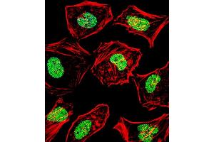 Fluorescent confocal image of Hela cell stained with HAND2 Antibody (Center) (ABIN1538642 and ABIN2848660). (HAND2 anticorps  (AA 81-110))