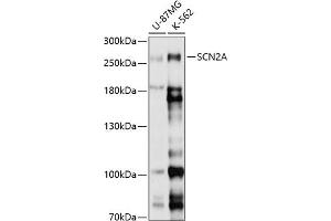 Western blot analysis of extracts of various cell lines, using SCN2A antibody (ABIN6130717, ABIN6147435, ABIN6147436 and ABIN6214873) at 1:1000 dilution. (SCN2A anticorps  (AA 275-401))