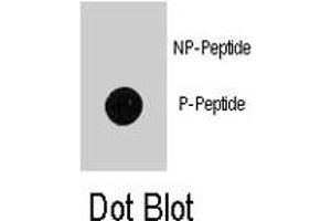 Dot blot analysis of MAP1LC3B (phospho T12) polyclonal antibody  on nitrocellulose membrane. (LC3B anticorps  (pThr12))