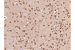 Paraformaldehyde-fixed, paraffin embedded rat brain; Antigen retrieval by boiling in sodium citrate buffer (pH6) for 15min; Block endogenous peroxidase by 3% hydrogen peroxide for 30 minutes; Blocking buffer (normal goat serum) at 37°C for 20min; Antibody incubation with CCDC42 Polyclonal Antibody, Unconjugated (bs-8131R) at 1:200 overnight at 4°C, followed by a conjugated secondary and DAB staining.