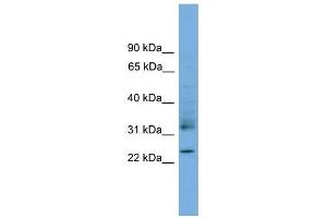 RHOJ antibody used at 1 ug/ml to detect target protein. (RHOJ anticorps  (Middle Region))