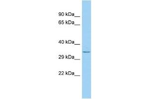 Host: Rabbit Target Name: PLD5 Sample Type: Fetal Lung lysates Antibody Dilution: 1. (PLD5 anticorps  (C-Term))