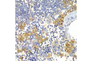 Immunohistochemistry of paraffin-embedded rat spleen using NOTCH1 antibody. (Notch1 anticorps)