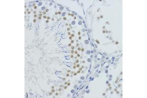 Immunohistochemistry of paraffin-embedded rat testis using MonoMethyl-Histone H4-K20 antibody (ABIN3016044, ABIN3016045, ABIN3016046, ABIN1680258 and ABIN6219531) at dilution of 1:200 (40x lens). (Histone H4 anticorps  (meLys20))