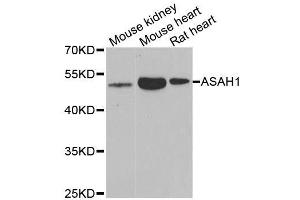 Western blot analysis of extracts of various cell lines, using ASAH1 antibody. (ASAH1 anticorps  (AA 140-389))