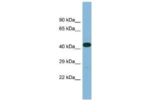 Western Blotting (WB) image for anti-Leucine Rich Repeat Containing 49 (LRRC49) (C-Term) antibody (ABIN2787019) (LRRC49 anticorps  (C-Term))