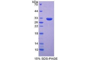SDS-PAGE (SDS) image for Ring Finger Protein 112 (RNF112) (AA 256-504) protein (His tag) (ABIN1980893)