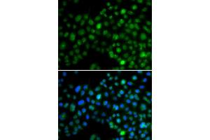 Immunofluorescence analysis of MCF-7 cells using NFIL3 antibody (ABIN6128336, ABIN6144564, ABIN6144566 and ABIN6218240). (NFIL3 anticorps  (AA 133-462))