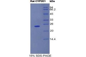 SDS-PAGE (SDS) image for Cytochrome P450, Family 2, Subfamily E, Polypeptide 1 (CYP2E1) (AA 126-309) protein (His tag) (ABIN1525406) (CYP2E1 Protein (AA 126-309) (His tag))