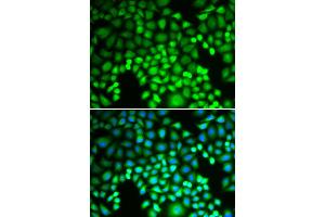 Immunofluorescence analysis of U2OS cells using PSMA4 antibody (ABIN6291447). (PSMA4 anticorps)