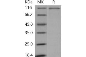 Western Blotting (WB) image for Mitogen-Activated Protein Kinase Kinase Kinase Kinase 2 (MAP4K2) protein (GST tag,His tag) (ABIN7317061)