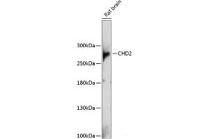 Western blot analysis of extracts of Rat brain using CHD2 Polyclonal Antibody at dilution of 1:1000. (CHD2 anticorps)