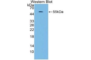 Western blot analysis of the recombinant protein. (MAPK7 anticorps  (AA 560-793))