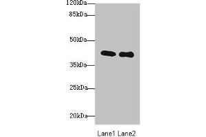 Western blot All lanes: P2RY13 antibody at 3 μg/mL Lane 1: HT29 whole cell lysate Lane 2: Colo320 whole cell lysate Secondary Goat polyclonal to rabbit IgG at 1/10000 dilution Predicted band size: 41, 39 kDa Observed band size: 41 kDa