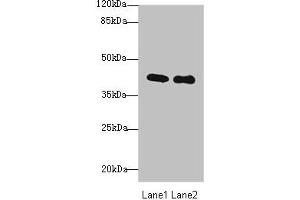 Western blot All lanes: P2RY13 antibody at 3 μg/mL Lane 1: HT29 whole cell lysate Lane 2: Colo320 whole cell lysate Secondary Goat polyclonal to rabbit IgG at 1/10000 dilution Predicted band size: 41, 39 kDa Observed band size: 41 kDa (Purinergic Receptor P2Y, G-Protein Coupled, 13 (P2RY13) (AA 162-190) anticorps)
