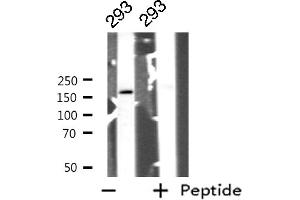 Western blot analysis of GRF-1 expression in 293 whole cell lysates,The lane on the left is treated with the antigen-specific peptide. (GRLF1 anticorps  (Internal Region))