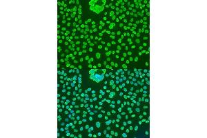 Immunofluorescence analysis of U2OS cells using POU5F1 antibody. (OCT4 anticorps)