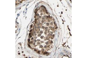 Phospho-ERK1/2 (Thr202/Tyr204) Antibody for IHC in human testis