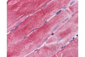 IHC testing of FFPE human skeletal muscle tissue with BAG3 antibody at 3. (BAG3 anticorps)