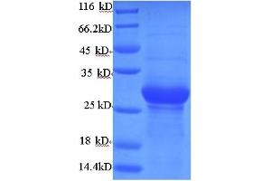 SDS-PAGE (SDS) image for Adiponectin (ADIPOQ) (AA 18-240) protein (His-SUMO Tag) (ABIN5711365)